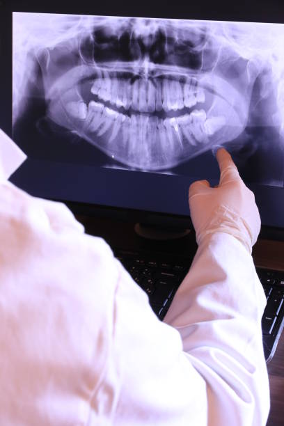 Best Emergency Dentist for Lost Fillings or Crowns in Buena Vista, CO